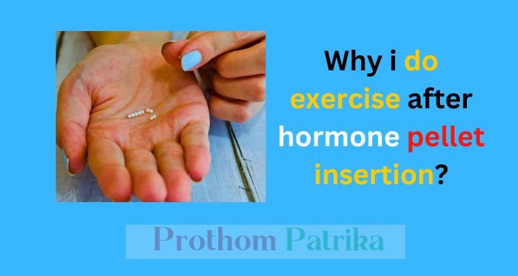 When can i exercise after hormone pellet insertion 