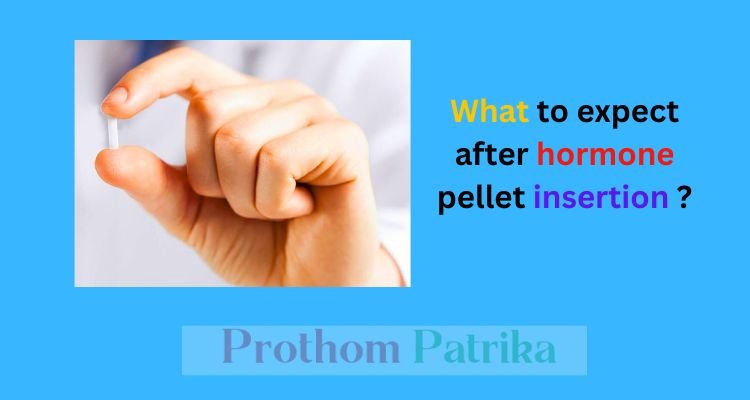 When can i exercise after hormone pellet insertion 