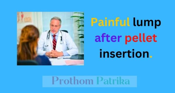 High-Quality When Can I Exercise After Hormone Pellet Insertion Artwork Nature High-Quality When Can I Exercise After Hormone Pellet Insertion Artwork Nature