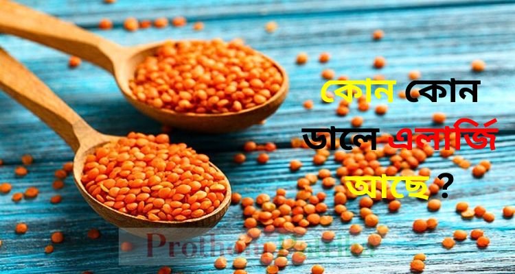 কোন কোন ডালে এলার্জি আছে