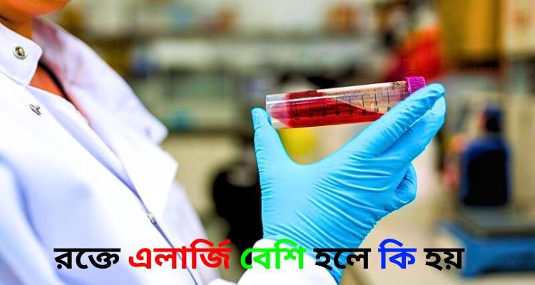 রক্তে এলার্জি বেশি হলে কি হয়